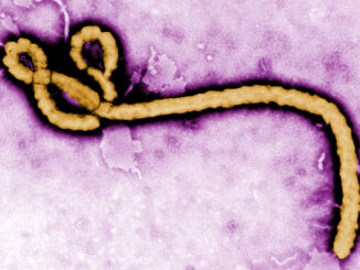 Ebola Virus
