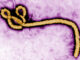 Ebola Virus