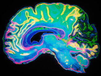 Artificially Coloured MRI Scan Of Human Brain. Daisy-Daisy/Alamy. MHE World