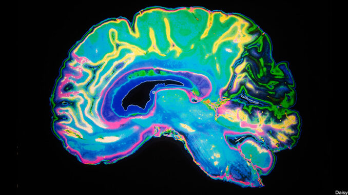 Artificially Coloured MRI Scan Of Human Brain. Daisy-Daisy/Alamy. MHE World