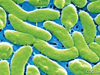 Vibrio vulnificus bacteria