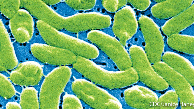 072215_03P_FS Vibrio vulnificus bacteria