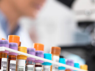 scientist viewing a sample using a microscope with rows of specimens in focus in front of her.