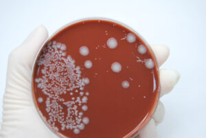 E.coli bacteria in petri dish