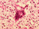 Measles under microscope