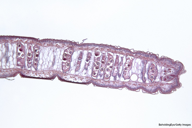 Microscopic photo of a tapeworm